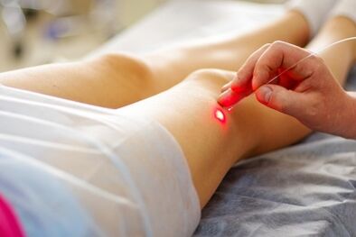 Laser terapia