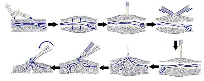 Varadi operazioa